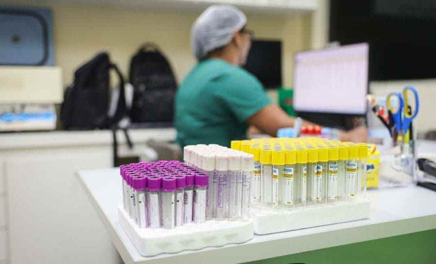 Informação, prevenção e acolhimento são o caminho para combater o avanço do HIV e AIDS no estado